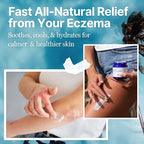 The Ocean Healed My Eczema Natural & Soothing Eczema Cream