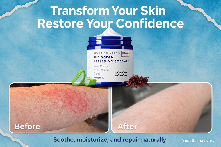 Eczema irritated skin problem